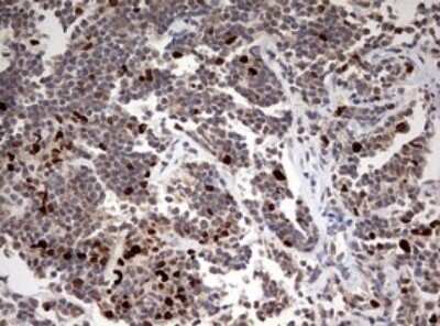Immunohistochemistry: TOP2A Antibody (OTI2A9) - Azide and BSA Free [NBP2-74558]