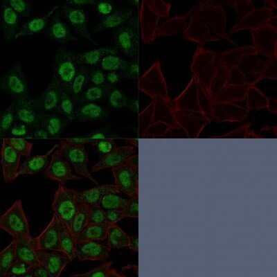 Immunocytochemistry/ Immunofluorescence: TOP2A Antibody (TOP2A/1361) - Azide and BSA Free [NBP2-54546]