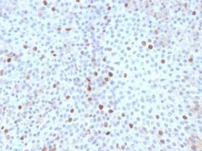Immunohistochemistry-Paraffin: TOP2A Antibody (TOP2A/1361) - Azide and BSA Free [NBP2-54546]