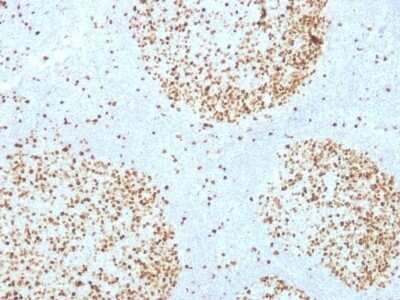 Immunohistochemistry-Paraffin: TOP2A Antibody (TOP2A/1361) - Azide and BSA Free [NBP2-54546]