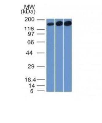 Western Blot: TOP2A Antibody (TOP2A/1361)Azide and BSA Free [NBP2-54546]