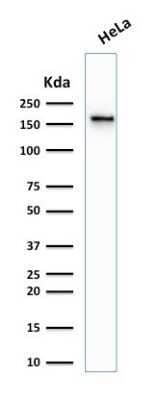 Western Blot: TOP2A Antibody (TOP2A/1361)Azide and BSA Free [NBP2-54546]