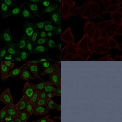 Immunocytochemistry/ Immunofluorescence: TOP2A Antibody (TOP2A/1361) [NBP2-53281]