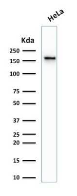 Western Blot: TOP2A Antibody (TOP2A/1361) [NBP2-53281]