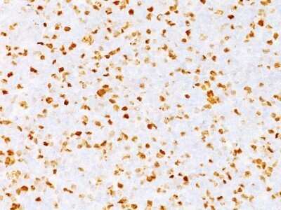 Immunohistochemistry-Paraffin: TOP2A Antibody (TOP2A/1362) - Azide and BSA Free [NBP2-54545]