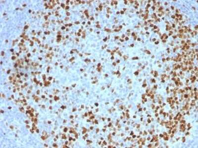 Immunohistochemistry-Paraffin: TOP2A Antibody (TOP2A/1362) - Azide and BSA Free [NBP2-54545]