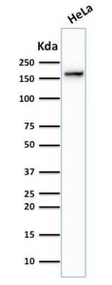 Western Blot: TOP2A Antibody (TOP2A/1362)Azide and BSA Free [NBP2-54545]