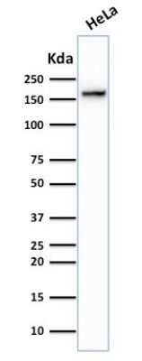 Western Blot: TOP2A Antibody (TOP2A/1362) [NBP2-53282]