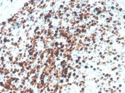 Immunohistochemistry-Paraffin: TOP2A Antibody (TOP2A/4397R) - Azide and BSA Free [NBP3-08756]