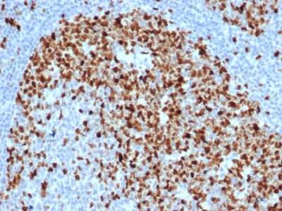 Immunohistochemistry-Paraffin: TOP2A Antibody (TOP2A/6570R) - Azide and BSA Free [NBP3-08757]