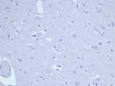 Immunohistochemistry-Paraffin: TOP2A Antibody (TOP2A/6570R) - Azide and BSA Free [NBP3-08757]