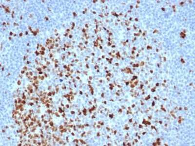 Immunohistochemistry-Paraffin: TOP2A Antibody (TOP2A/6570R) - Azide and BSA Free [NBP3-08757]