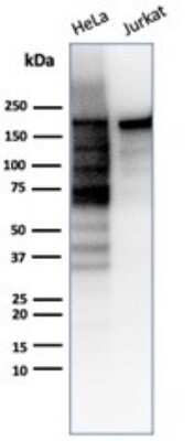 Western Blot: TOP2A Antibody (TOP2A/6570R)Azide and BSA Free [NBP3-08757]