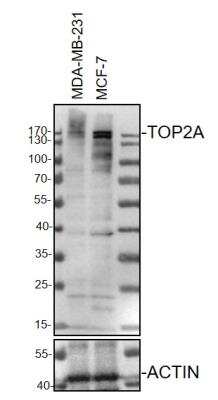 Western Blot: TOP2A Antibody [NBP1-86928]