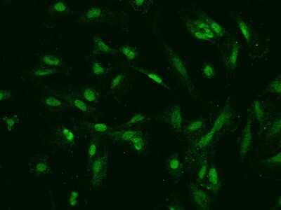 Immunocytochemistry/ Immunofluorescence: TOP2B Antibody [NBP2-97789]