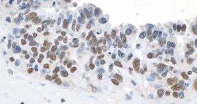 Immunohistochemistry-Paraffin: TOP2B Antibody [NB100-40842]