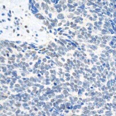 Immunohistochemistry-Paraffin: TOP2B Antibody [NB100-40842]