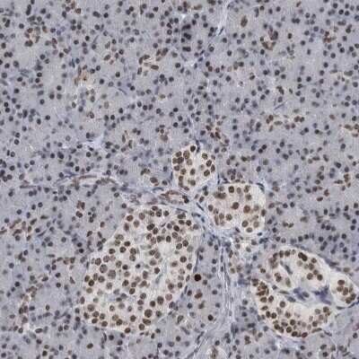 Immunohistochemistry-Paraffin: TOP2B Antibody [NBP1-89527]