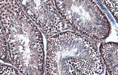 Immunohistochemistry-Paraffin: TOP2B Antibody [NBP2-20684]