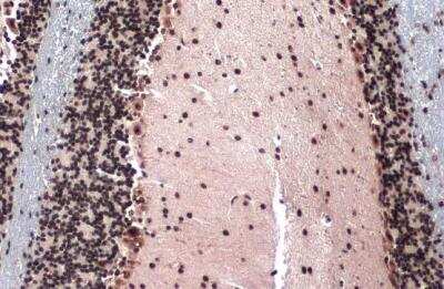 Immunohistochemistry-Paraffin: TOP2B Antibody [NBP2-20684]