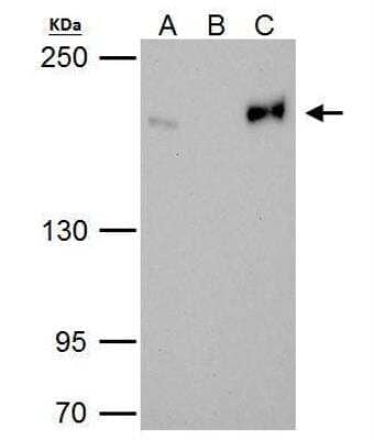 Immunoprecipitation: TOP2B Antibody [NBP2-20684]