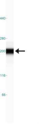Simple Western: TOP2B Antibody [NBP1-89527]