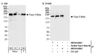 Western Blot: TOP2B Antibody [NB100-40842]
