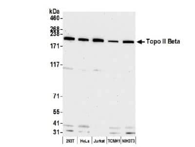 Western Blot: TOP2B Antibody [NB100-40842]