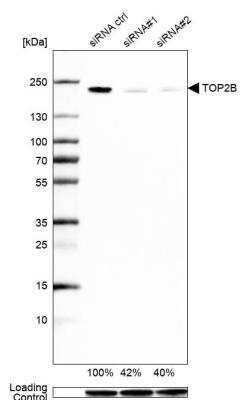 Western Blot: TOP2B Antibody [NBP1-89527]