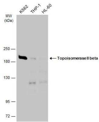 Western Blot: TOP2B Antibody [NBP2-20684]