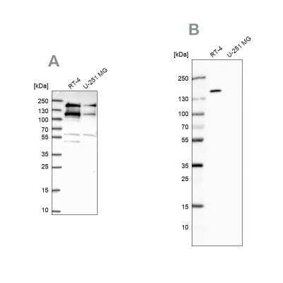 Western Blot: TOP2B Antibody [NBP2-58728]