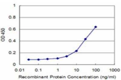 ELISA: TOPORS Antibody (1A5) [H00010210-M13]