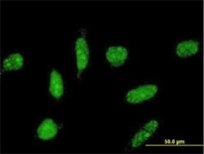 Immunocytochemistry/ Immunofluorescence: TOPORS Antibody (4G4) [H00010210-M02]