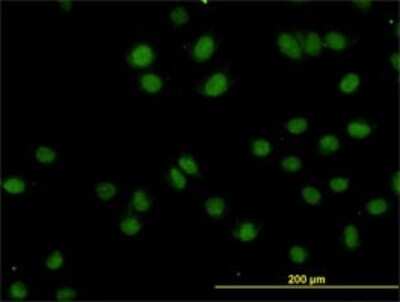 Immunocytochemistry/ Immunofluorescence: TOPORS Antibody (5G11) [H00010210-M01]