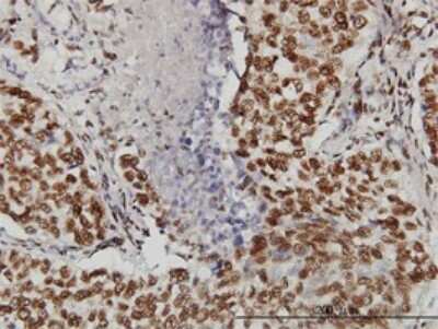 Immunohistochemistry-Paraffin: TOPORS Antibody (5G11) [H00010210-M01]