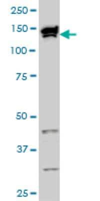 Western Blot: TOPORS Antibody (5G11) [H00010210-M01]