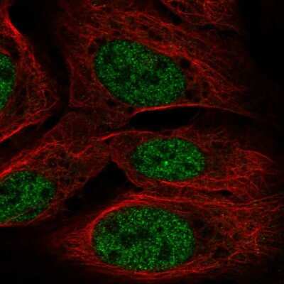 Immunocytochemistry/ Immunofluorescence: TOPORS Antibody [NBP2-56069]