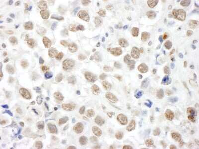 Immunohistochemistry-Paraffin: TOPORS Antibody [NBP1-22976]