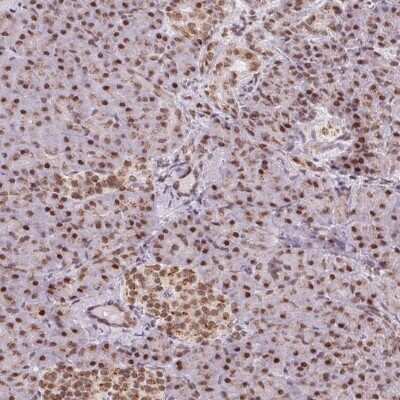 Immunohistochemistry-Paraffin: TOPORS Antibody [NBP2-39060]