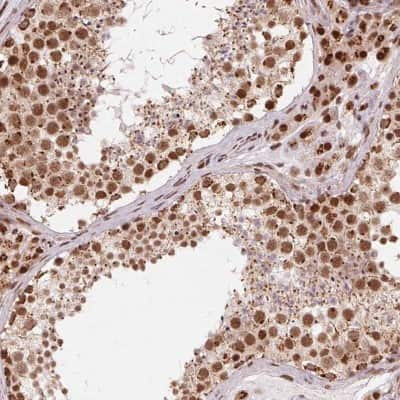 Immunohistochemistry-Paraffin: TOPORS Antibody [NBP2-39060]