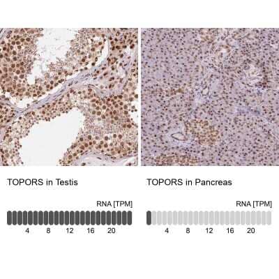 Immunohistochemistry-Paraffin: TOPORS Antibody [NBP2-39060]