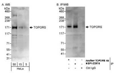 Western Blot: TOPORS Antibody [NBP1-22976]