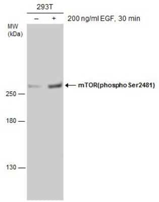 Western Blot: TOR/mTOR [p Ser2481] Antibody [NBP3-13172]