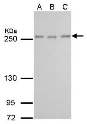 Western Blot: TOR/mTOR Antibody (6611) [NBP2-43658]