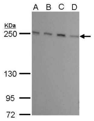 Western Blot: TOR/mTOR Antibody (6611) [NBP2-43658]