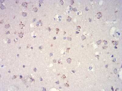Immunohistochemistry-Paraffin: TOR/mTOR Antibody (8H5A5) - BSA Free [NBP2-52513]