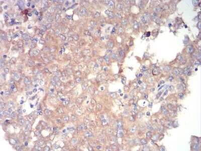 Immunohistochemistry-Paraffin: TOR/mTOR Antibody (8H5A5) - BSA Free [NBP2-52513]
