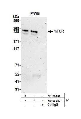 Immunoprecipitation: TOR/mTOR Antibody [NB100-240]