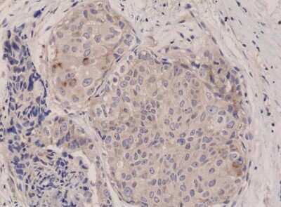 Immunohistochemistry-Paraffin: TOR/mTOR Antibody (RM274) [NBP2-61590]