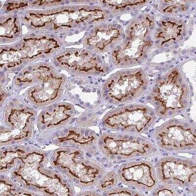 Immunohistochemistry-Paraffin: TOR1AIP2 Antibody [NBP2-34109]